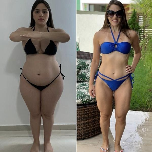 Antes e Depois Ana