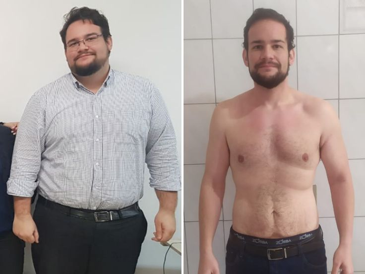 Antes e Depois André