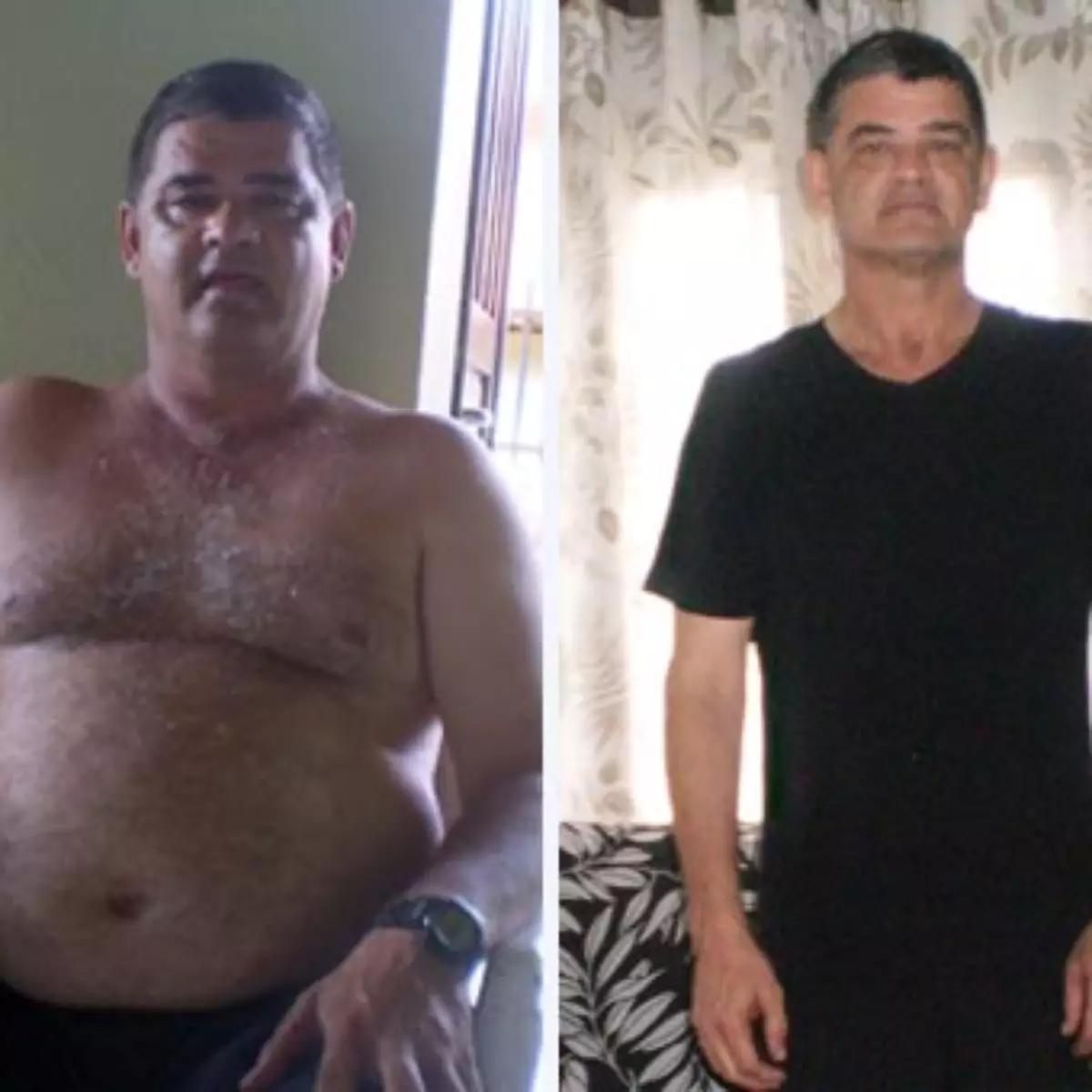 Antes e Depois Carlos