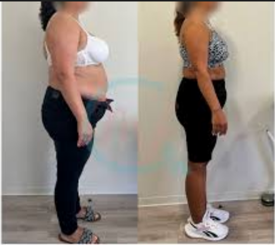 Antes e Depois Marcos