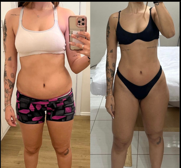 Antônia Antes e Depois