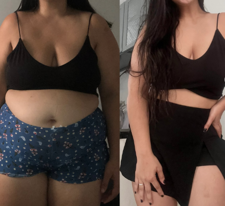 Antes e depois do tratamento